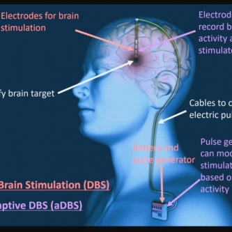 brain-stimulator
